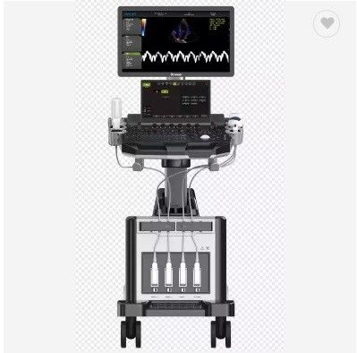 اکوکاردیوگرافی 2 بعدی 3 بعدی 4 بعدی دستگاه سونوگرافی داپلر رنگی اکو ترولی قلب